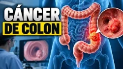 COLON CANCER WITH DR. ISIS ALVARADO ON CHANNEL 14 | October 29, 2026