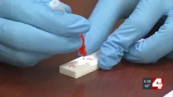 St. Louis sees rise in flu and other respiratory viruses