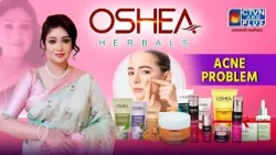 ACNE PROBLEM । OSHEA HERBAL #beauty