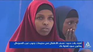 Doctors Without Borders: Half of the children in refugee camps in southwest Somalia suffer from s...