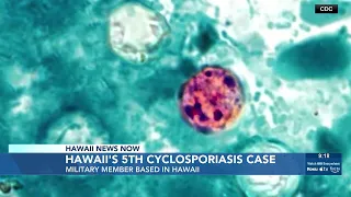 DOH confirms 5th cyclosporiasis case in Hawaii