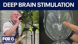 Deep brain stimulation helps Hartland musician with Parkinson's | FOX6 News Milwaukee