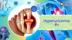 Hyperuricemia কী। Health and Wellness