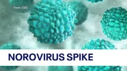 Norovirus cases rising in the Northeast: What you need to know