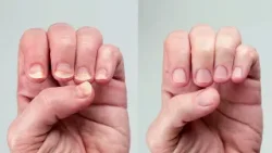 Воск Nemozol+ для ногтей и кутикулы. Shop & Show (Красота) Воск Nemozol+ для ногтей и кутикулы. Shop & Show (Красота)