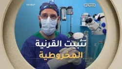 #شاهد عملية تثبيت القرنية المخروطية ناجحة بعيادة شيالي بالعاصمة ?‍⚕️?