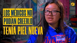 Doctors couldn't believe it: She had new skin | The power of a Miracle | Testimony of Healing