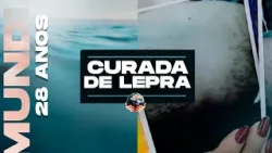 MILAGRE: CURADA DE LEPRA (especial 28 anos de IMPD)