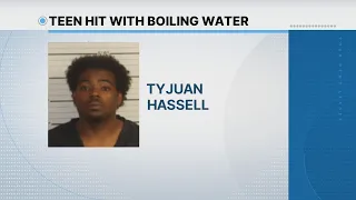 Man accused of burning teen with boiling water
