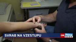 Nemocné Česko: Svrab i černý kašel jsou na vzestupu. Nákazu hlásí také škola v Sušici