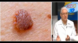 HPV Doesn't Discriminate: Specialist Debunks Myths About Transmission and Vaccines