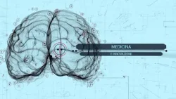 MI - St. 4 - 20a Puntata - Fibromi Uterini