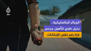 الجبائر البلاستيكية.. حل طبي محلي في غزة لمواجهة نقص المواد الطبية