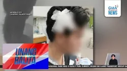 Binatilyo, sugatan matapos pukpukin ng palakol sa ulo ng isang lalaki; suspek,... | Unang Balita Binatilyo, sugatan matapos pukpukin ng palakol sa ulo ng isang lalaki; suspek,... | Unang Balita