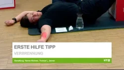 Erste Hilfe: Verbrennung