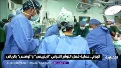 Today: Separation surgery for Tanzanian twins "Lightness" and "Lovelyness" in Riyadh