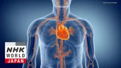 Detecting Heart Disease With Intravascular Imaging - Medical Frontiers