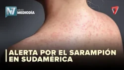 HEALTH ALERT | Low Measles vaccination coverage in South America is cause for concern