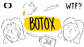 Jak funguje botox? | What the Fact?