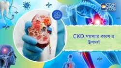 CKD সমস্যার কারণ ও উপসর্গ। Health and Wellness