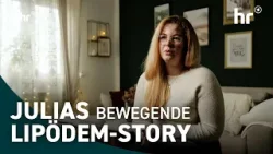 Lipödem: Liposuktion ist jetzt Kassenleistung Lipödem: Liposuktion ist jetzt Kassenleistung