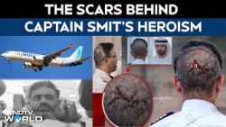 FlyDubai Cockpit Attack: The Injuries, Courage And Remarkable Recovery Of Captain Smit