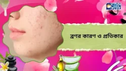 ব্রণর কারণ ও প্রতিকার। Beauty