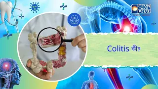 Colitis কী। Health and Wellness