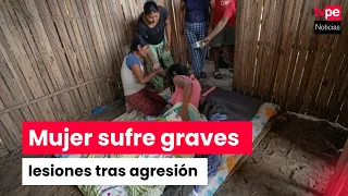 Madre queda postrada tras presunta agresión de su esposo en Bagua