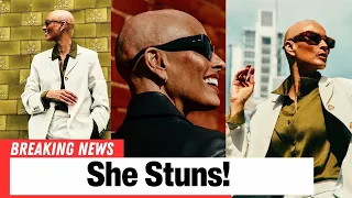 Melanie Sykes Debuts Bold New Look in First Shoot After Shaving Her Head