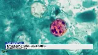 Johnson County sees sharp cyclosporiasis spike amid lettuce recalls