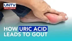 Gout Explained: Uric Acid Connection