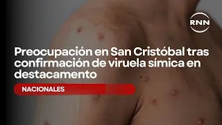 Concern in San Cristóbal following confirmation of monkeypox at police station