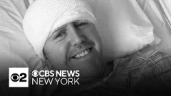 How DBS helped treat a CBS News New York sports producer's Parkinson's disease