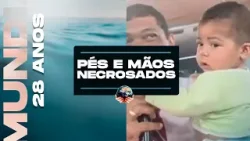 MILAGRE:  PÉS E MÃOS NECROSADOS (especial 28 anos de IMPD)