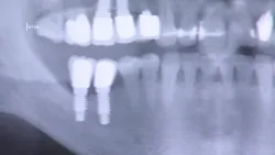 „CU UN ZÂMBET MAI APROAPE”