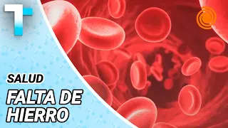 IRON DEFICIENCY ANEMIA: affects 30% of the WORLD'S POPULATION