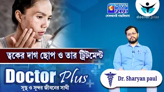 ত্বকের দাগ ছোপ ও তার ট্রিটমেন্ট   | DOCTOR PLUS