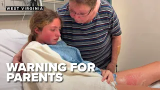 A warning for parents after toy explodes, teen suffers burns