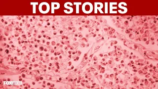 TOP STORIES | Upper East Side Legionnaires outbreak grows; US-Iran talks resume; weekend weather