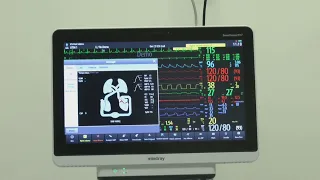 Canosa, nuova Tac di ultima generazione al Presidio post acuzie