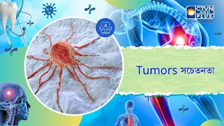 Tumors সচেতনতা। Health and Wellness