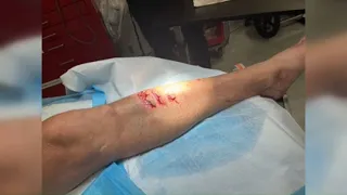 Connecticut man survives brutal shark attack in the Bahamas
