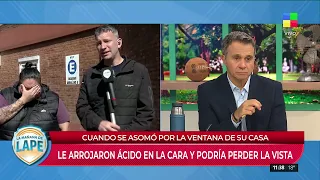 🔴LE ARROJARON ÁCIDO EN LA CARA Y PODRÍA PERDER LA VISTA