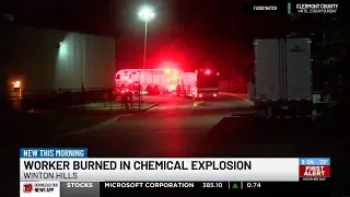 1 seriously injured after being burned at plastic facility, firefighters say