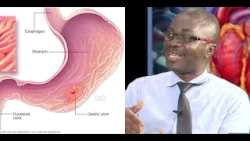 Peptic Ulcer Disease: Causes, Symptoms, Treatment And Possible Cure | HEALTHY LIVING