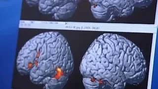Healthy midlife habits could delay dementia by up to 13 years, study finds