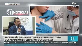 Honduras confirma nuevo caso de sarampión en bebé de seis meses y suma 12 contagios.