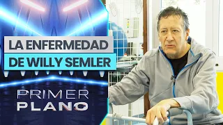 UNDERGOING TREATMENT!: Willy Semler's complex autoimmune disease - Primer Plano