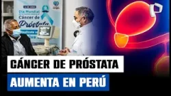 Cáncer de próstata en Perú: 7 de cada 10 casos se detectan tarde